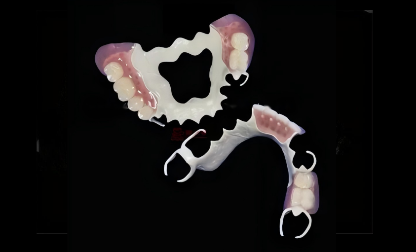 Peek  Framewrok  with  teeth